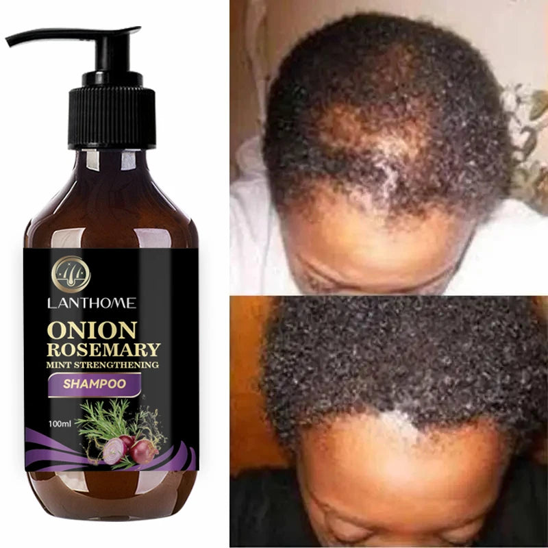 Schampoo Fast Hair Growth Rosemary Onion